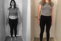 Zonisamide Weight Loss Reddit A Comprehensive Review